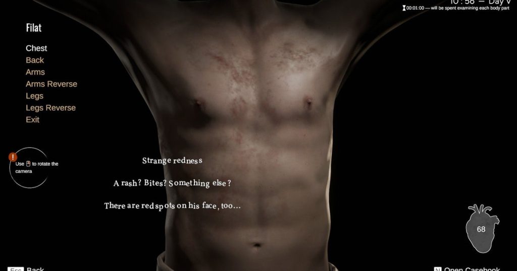 What's that appalling stench? Ah yes, Pathologic 3 is out on PC today